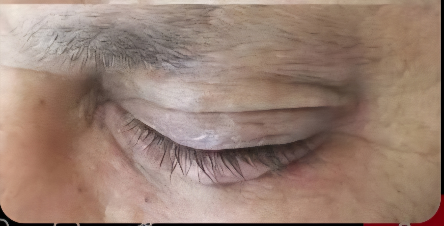 After skin care